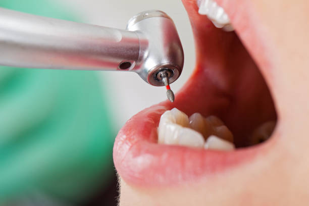 Best Emergency Cosmetic Dentistry (e.g., broken veneers) in Tremont, IL
